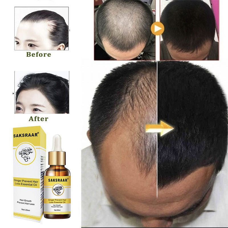 Natural Hair Loss serum
